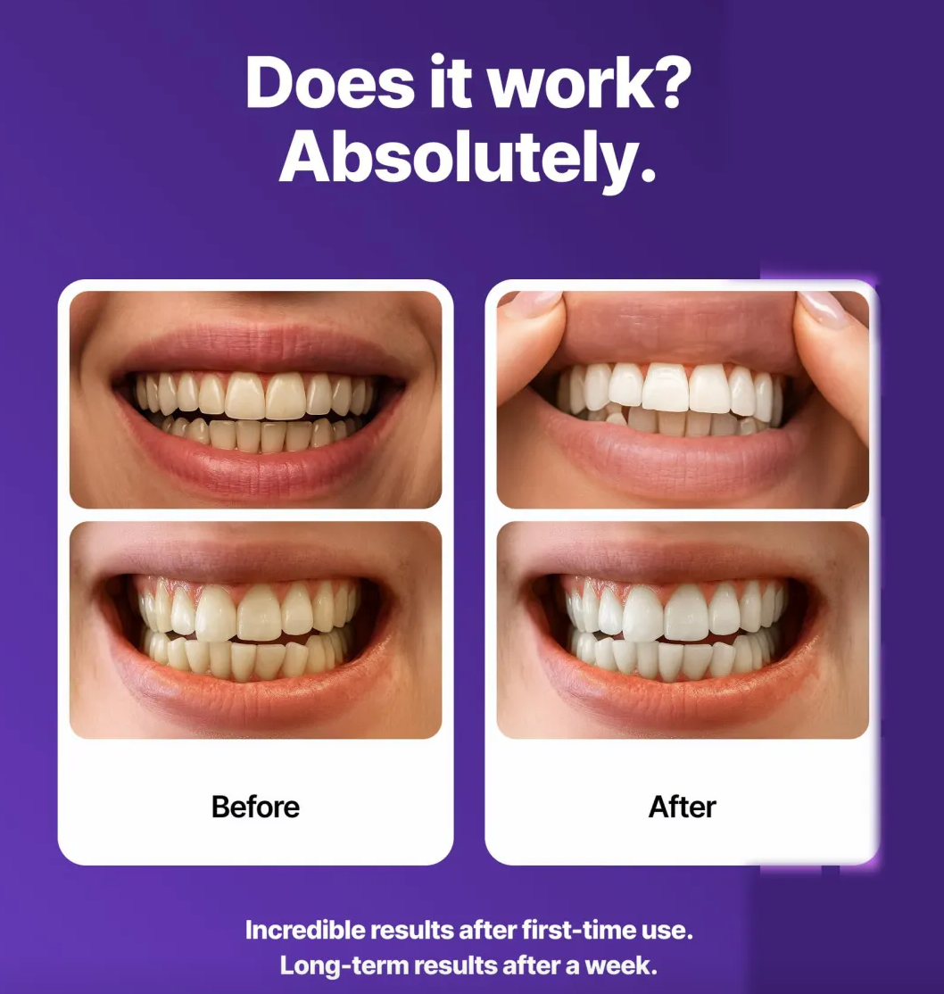 Teeth Whitening Strips