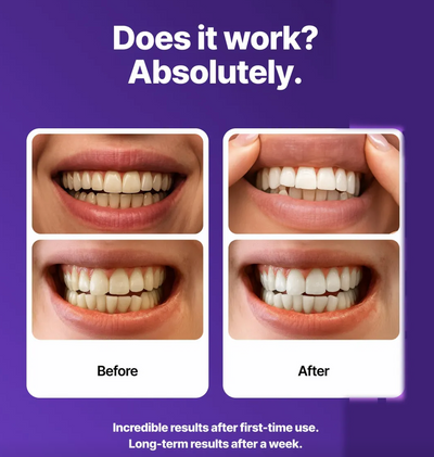 Teeth Whitening Strips